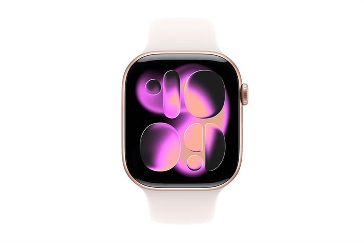 Apple Watch Series 11 GPS 46mm viền nhôm dây thể thao Màu Vàng Hồng