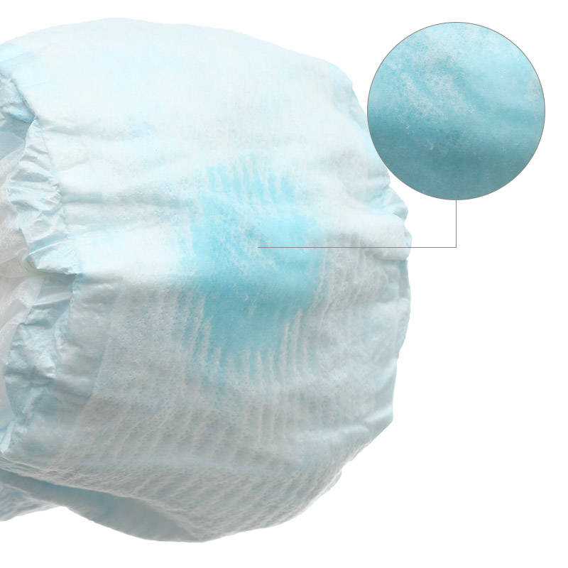 Tã dán Molfix Oxy size M 76 miếng (6 - 11 kg) 24